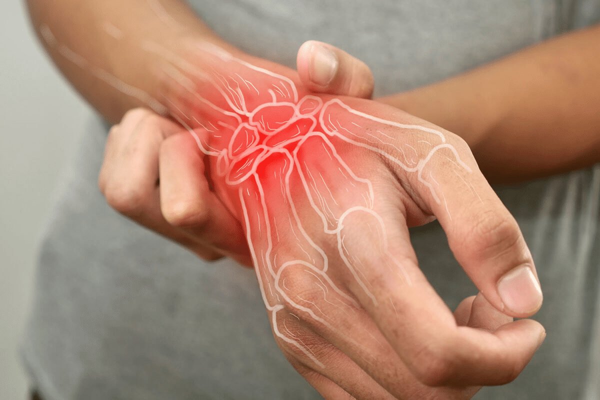 Wrist arthritis